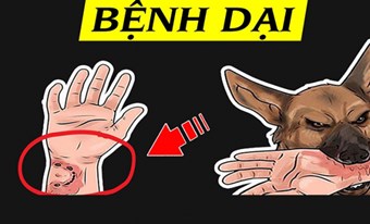 NGÀY THẾ GIỚI PHÒNG CHỐNG BỆNH DẠI – WORLD RABIES DAY  (28/9/2024)