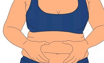 NGÀY THẾ GIỚI PHÒNG CHỐNG BÉO PHÌ  WORLD OBESITY DAY