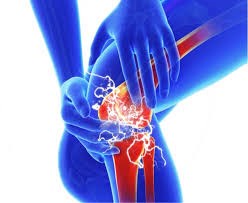 THOÁI HÓA KHỚP GỐI- NHỮNG ĐIỀU CẦN BIẾT