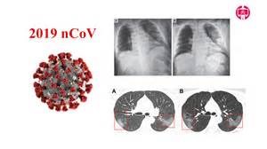 Thế giới: tình hình dịch bệnh COVID-19   đến 08h40 ngày 13/02/2012