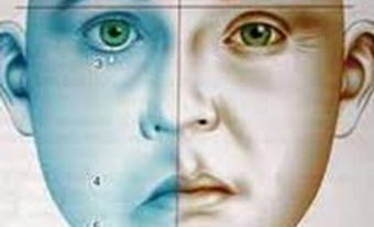 Cách phòng ngừa bệnh liệt mặt ngoại biên